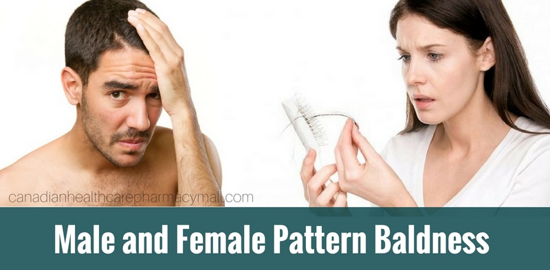 Male and Female Pattern Baldness_ Causes and Prevention